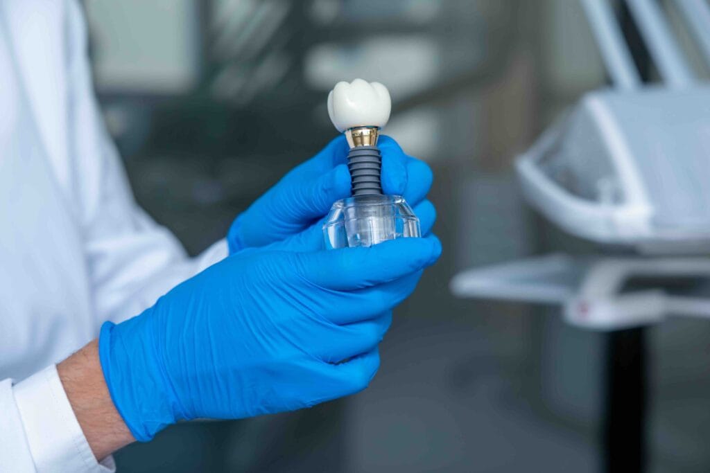 Come pulire impianti dentali